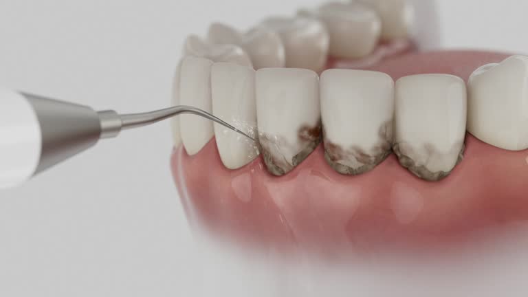 Reliable Dental contractor in Bangor, WI by Smile Center Dentistry